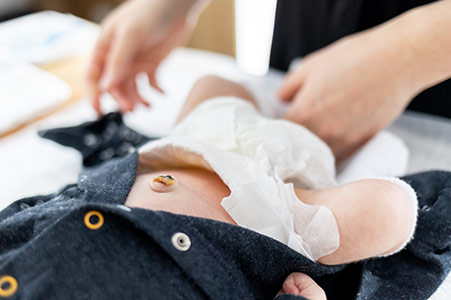 La cura dell’ombelico del neonato. Nervi saldi!